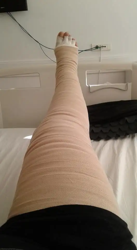 lipodem tedavisi