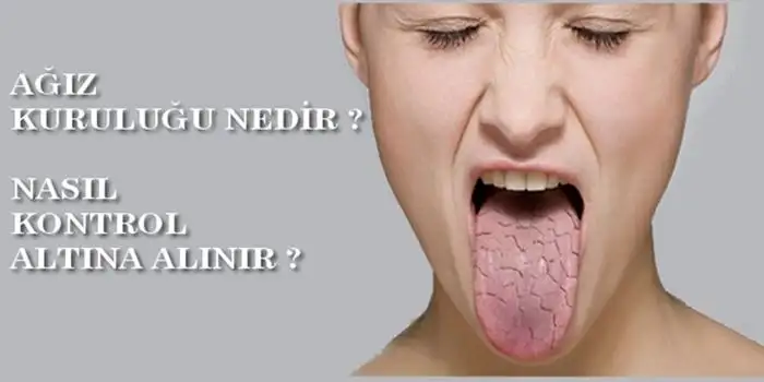49974_headline.webp