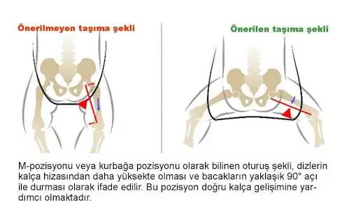 4D3ED3F3-1077-4E91-B34A-84197F8E9939.webp