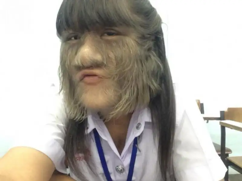 5a4e368b7af50707842dcc2a.webp