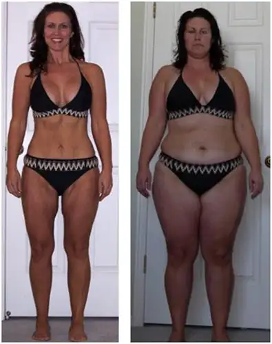 73-weight-loss-before-after_thumb.webp