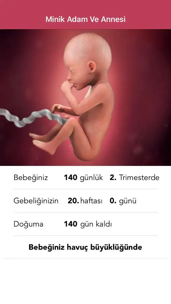 7A5F93CE-DC33-4913-A80F-E56C7677C7AA.webp
