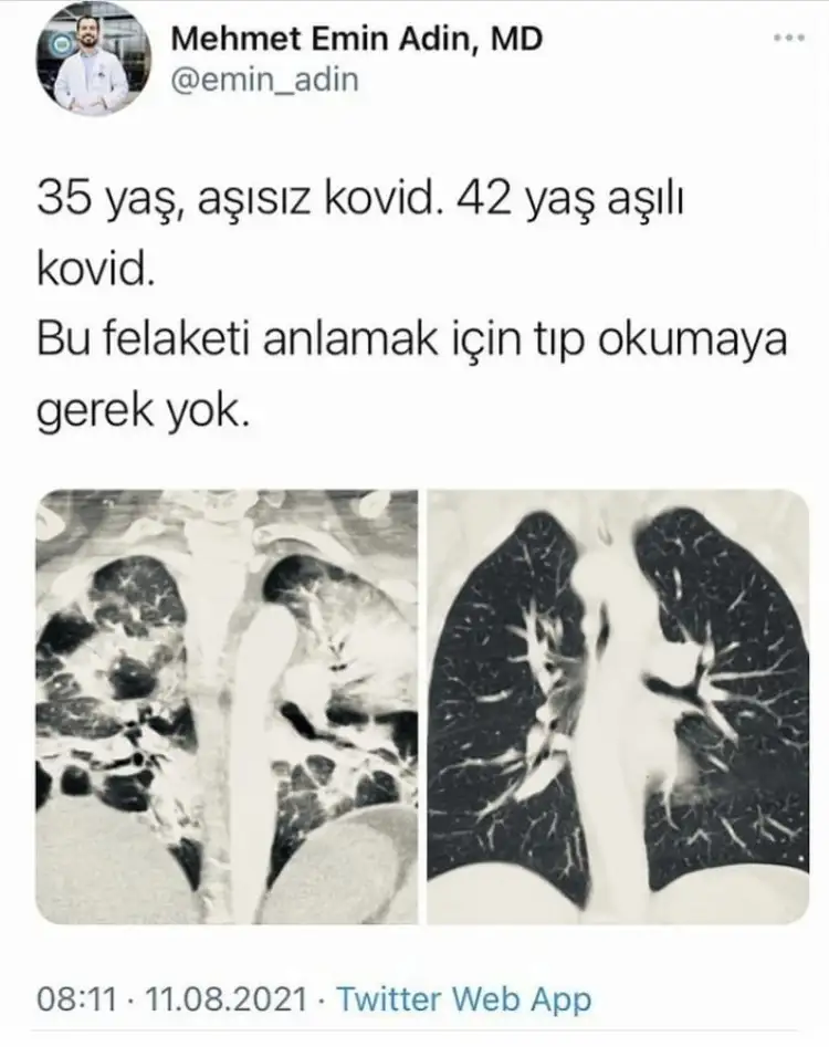 8AF62074-320B-48C3-9B25-6A4F1479CD7F.webp