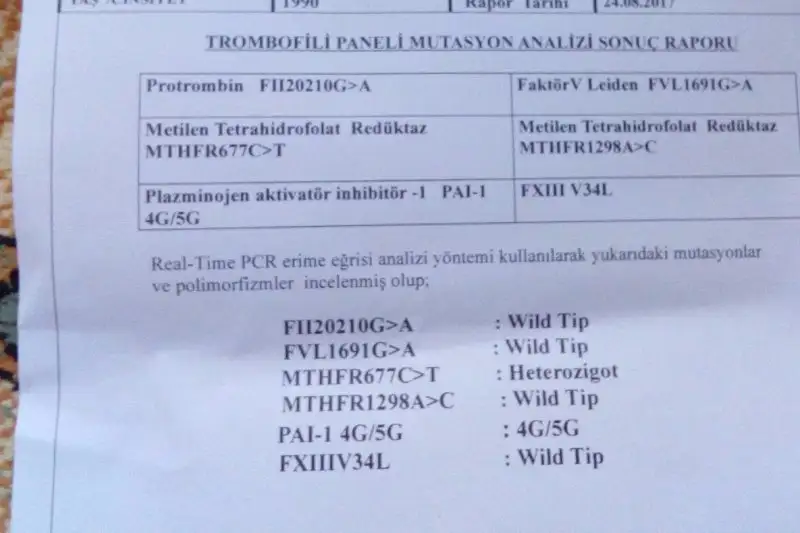 933270E4-9462-48E0-8FC5-38138BEDD897.webp