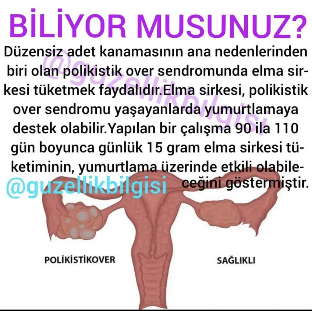 9AA1C068-56EE-4D06-B2A1-2F8A9CE58B77.webp