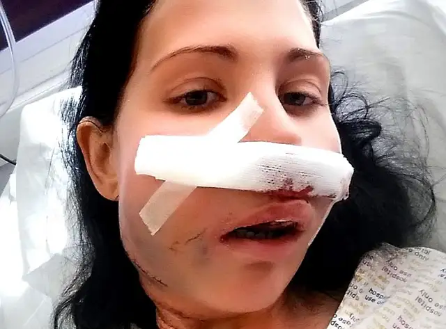 Adenoid Kistik Karsinom nedir (3).webp