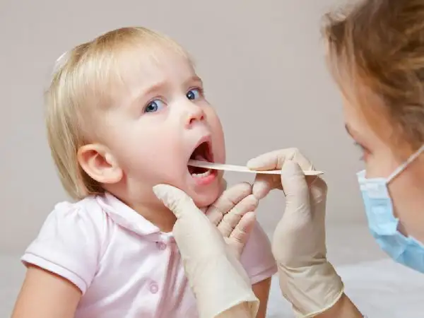 adenoidectomy.webp
