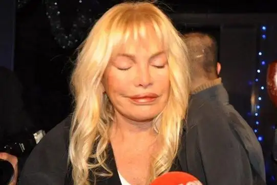 ajda-pekkan-agzini-kapatamadigi-icin-yakindan-7896082_8498_m.webp