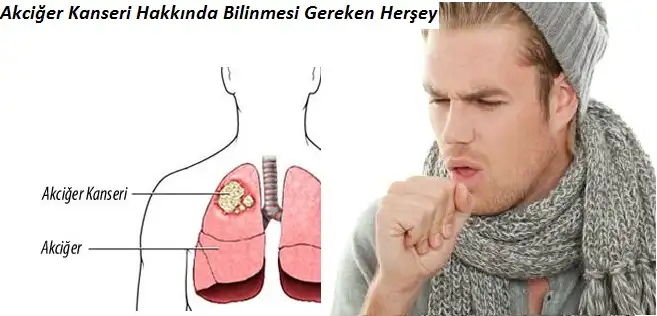 Akciğer-Kanseri-Hakkında-Bilinmesi-Gereken-Herşey-45436.webp