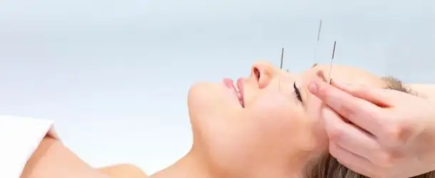akupunktur_tedavisi-610x250.webp