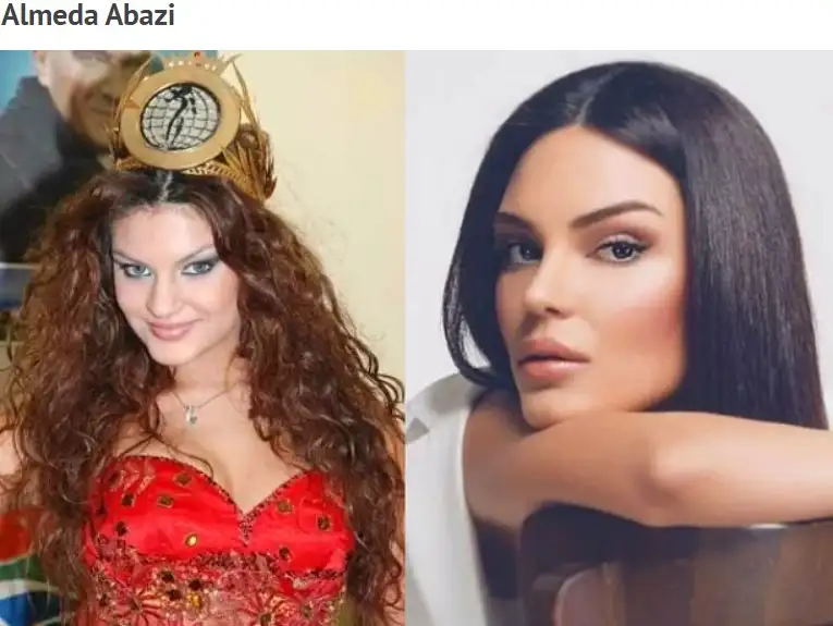 almeda_abazi_burun_estetigi.webp