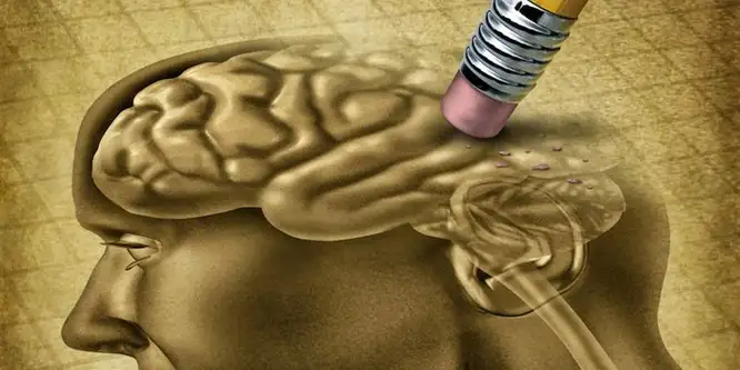 alzheimer-silgi-kafa.webp