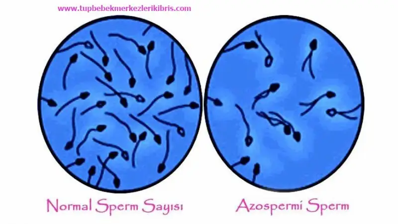 azospermi-konusuna resim.webp