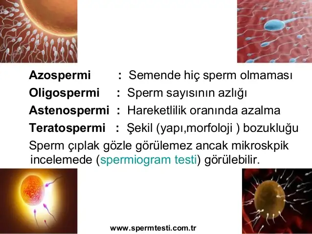 azospermi.webp