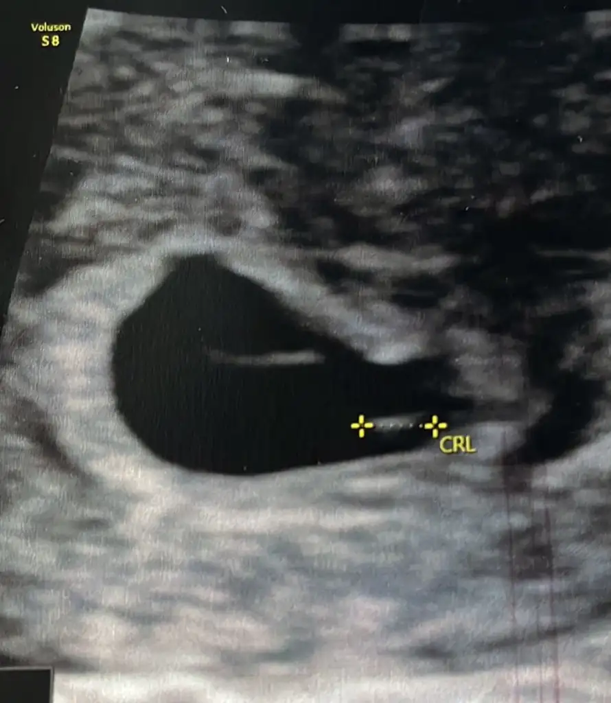 baby.webp