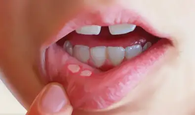 lezbiyen periscope