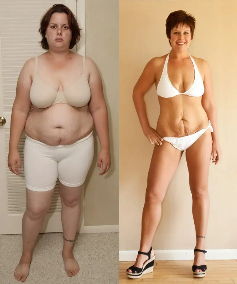 before-after-weight-loss-12.webp
