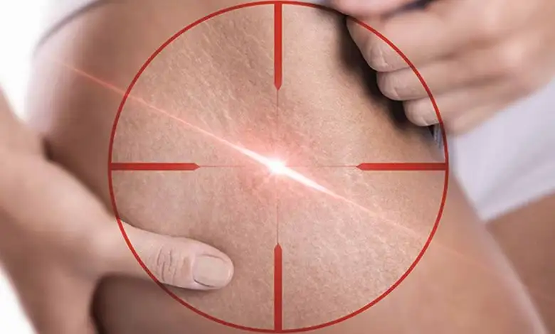 bio-oil-vucut-bakim-urunu-780x470.webp