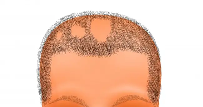 bu_belirtiler_varsa_cocugunuzu_doktora_goturun (6).webp