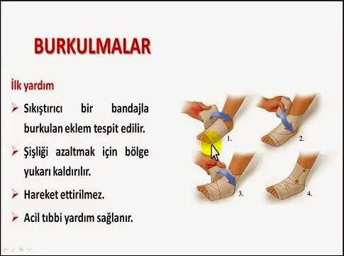 burkulma.webp