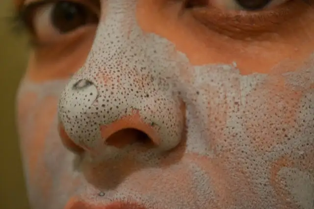 burun_siyah_nokta_maske.webp