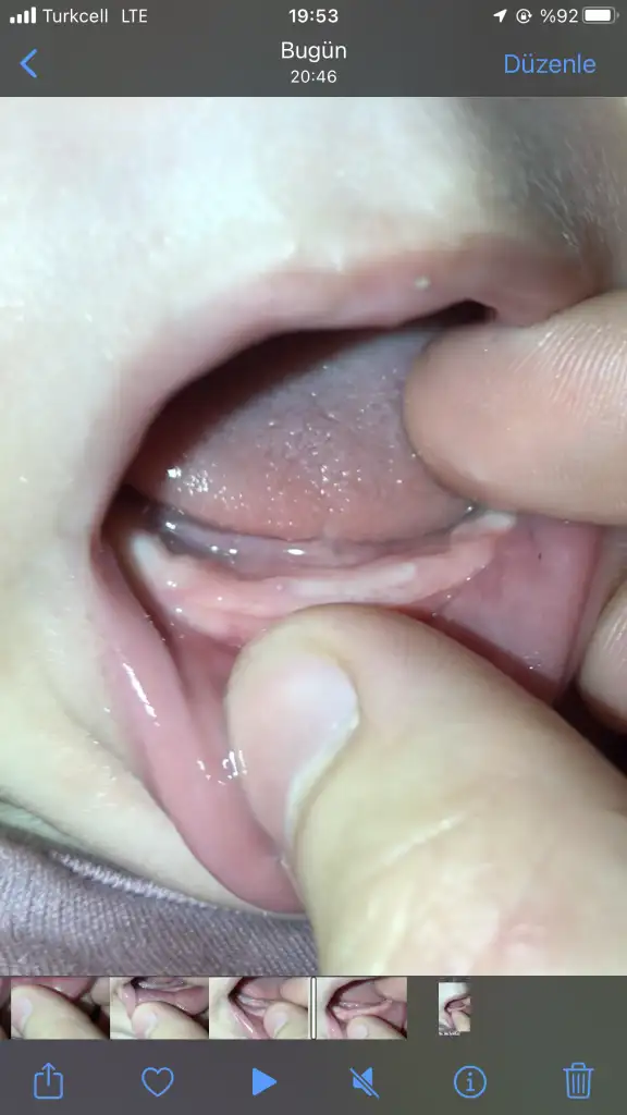 C47D5D03-4D6B-4042-B0D3-24E521D1239B.webp