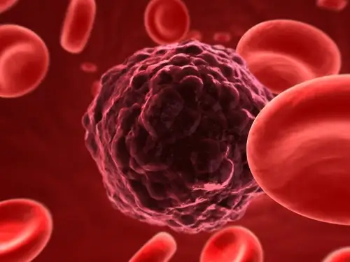Cancerous-cells.webp