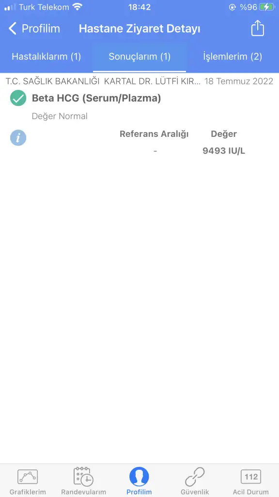 CEBE74A1-18EB-48EB-B4C3-D539B3290364.webp