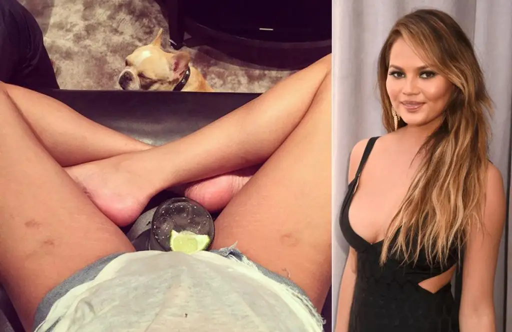 chrissy-teigen.webp