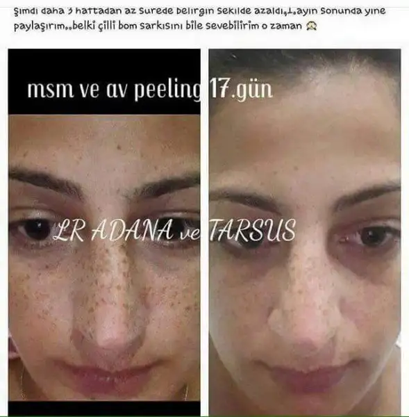 çil.webp