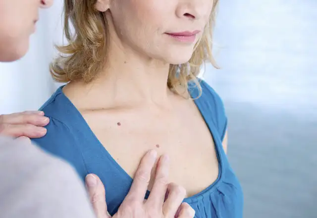 cilt-kanserine-karsi-ozon-tedavisi-5578994.webp