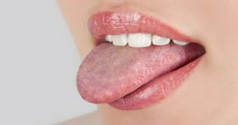 covington-smiles-2-1200x630.webp