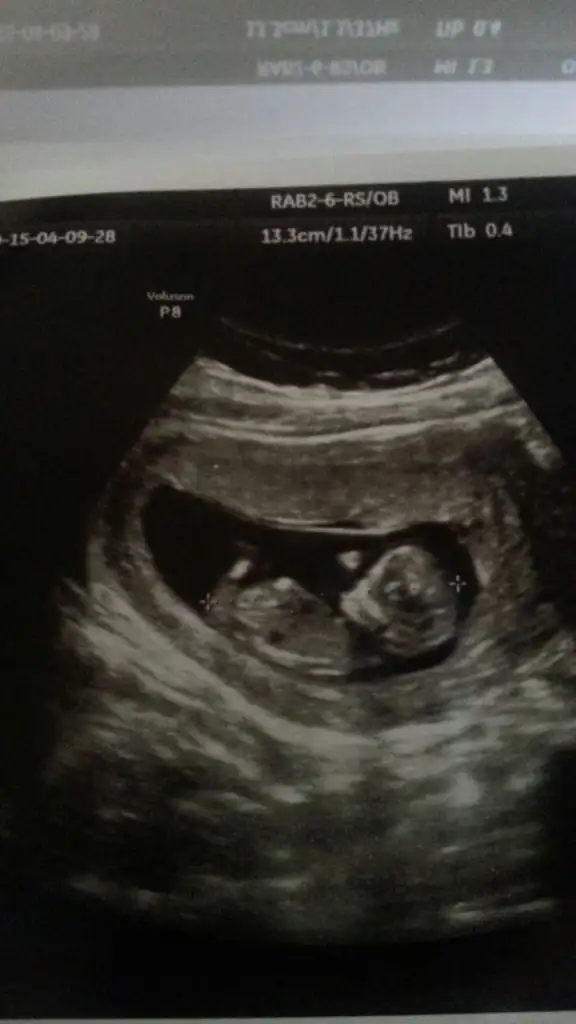 Cücük 13. haftada.webp