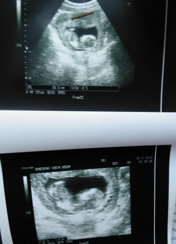 CYMERA_20151103_150619.webp
