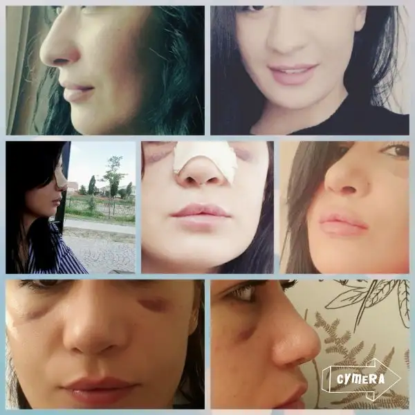 CYMERA_20160708_181700.webp