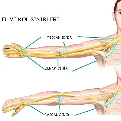 dirsekte-sinir-sikismasi.webp