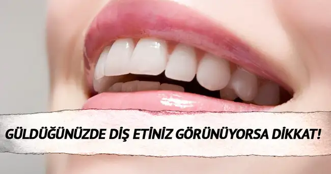 dis_eti.webp