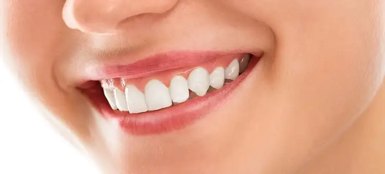 dis_eti_bakimi_nasil_olmali.webp