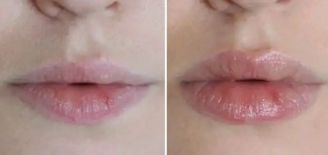Dudak_Kalinlastirma_Peeling_Maske.jpg