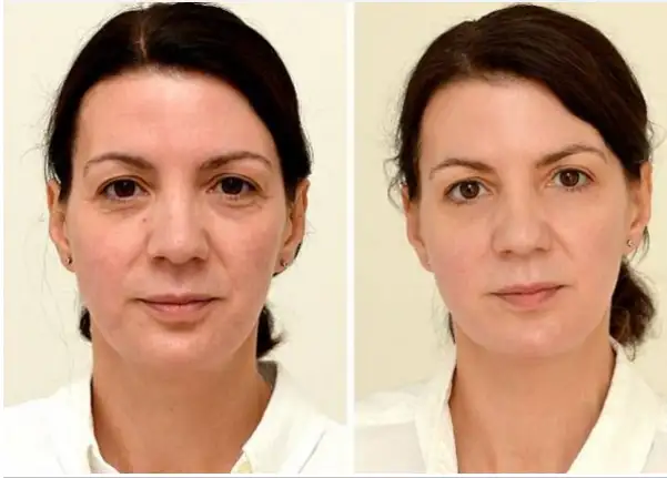 Ekran Alıntısı.webp