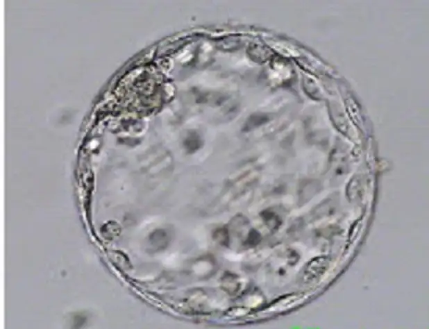 $embriyo-atlasi16.webp