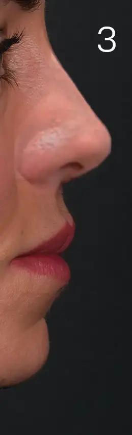 erhan-nose-mid-3yazar.webp