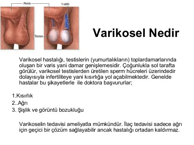 erkek-infertilitesi-ksrlk-7-638.webp