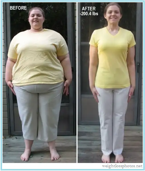 Extreme-Weight-Loss.webp