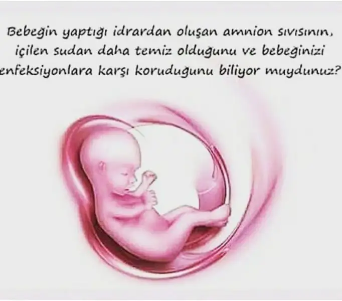 FB_IMG_1500099421713.webp