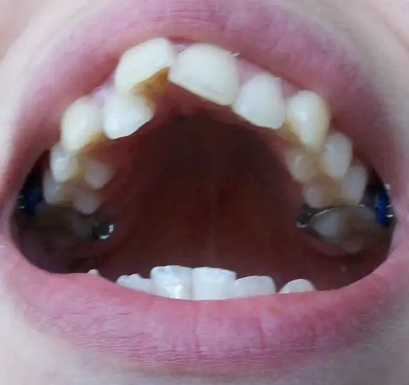 fghkjl.webp