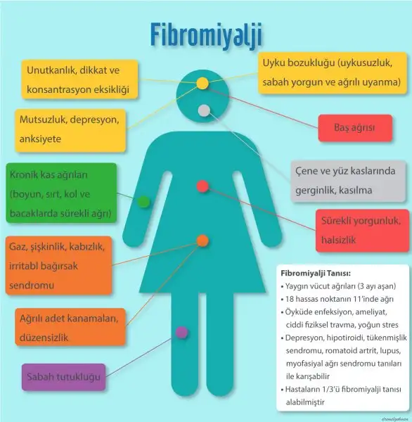 fibromiyalji-belirtileri-infografik-dr-emel-gokmen1.webp