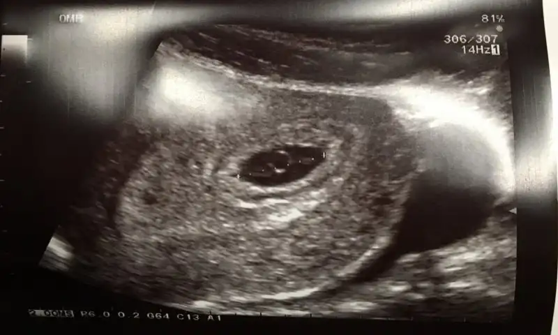 FullSizeRender (1).webp