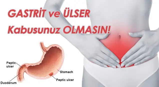 gastrit_tedavisi.webp