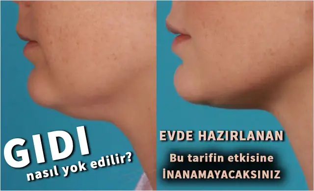 gidi-eritme-yollari-nelerdir--6166609.webp